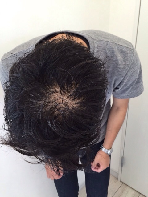 S氏 毛が生える 京丹後市の人気美容室 ベンチヘアサロン 公式サイト